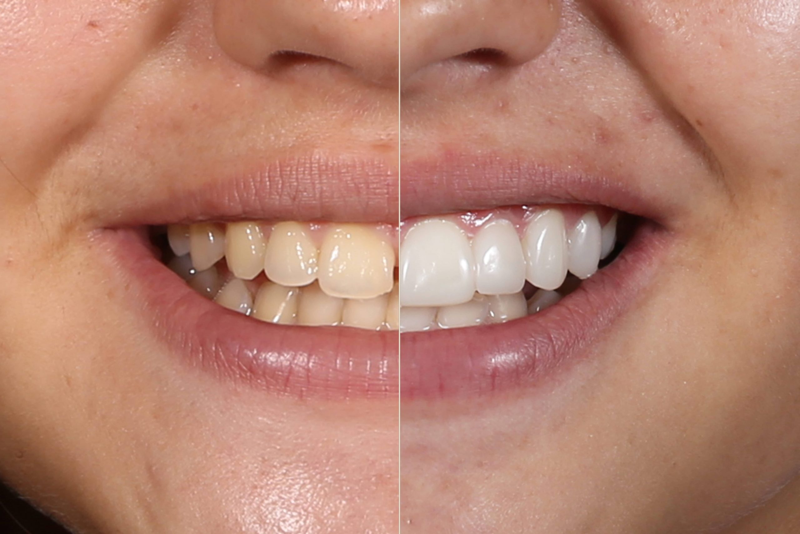 Dental Mexico Guide Best Dentists in Mexico Dental vacations in Mexico