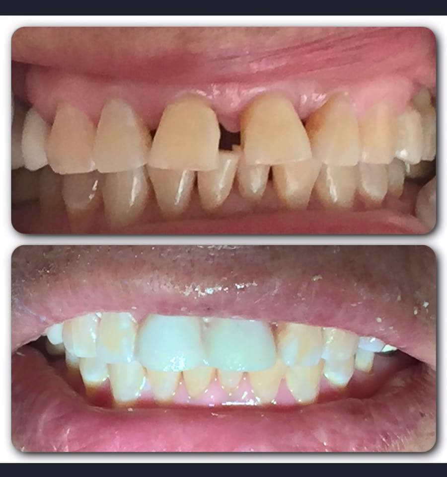 Adams Dental Dental Mexico