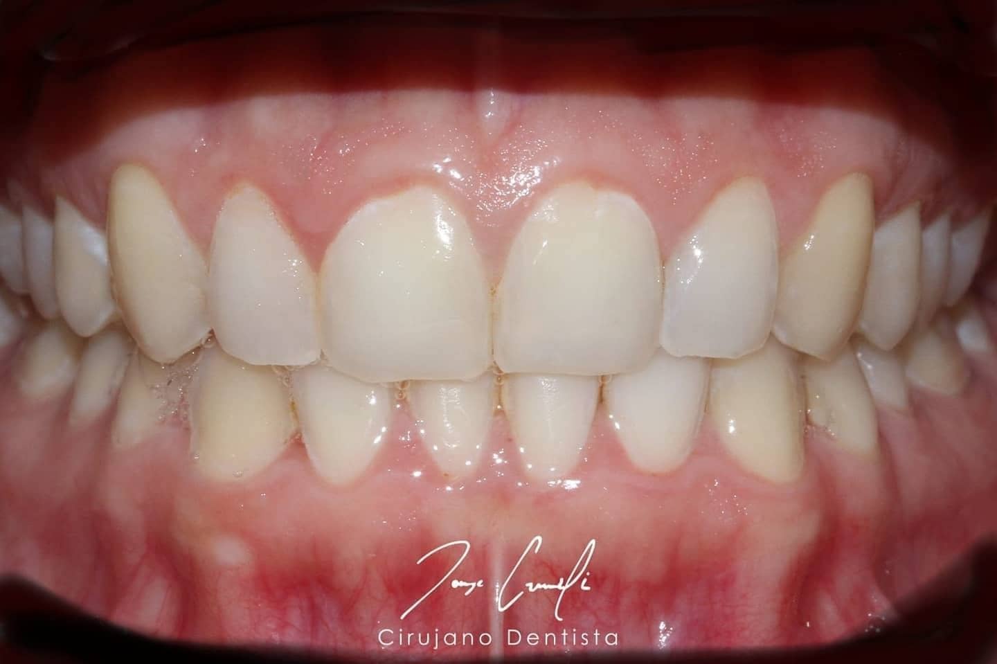 clinica-dental-cuauhtli-after