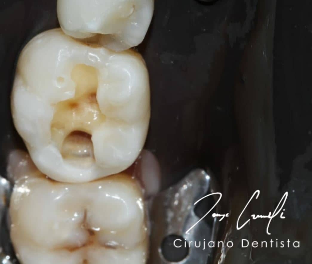 clinica-dental-cuauhtli-before-1