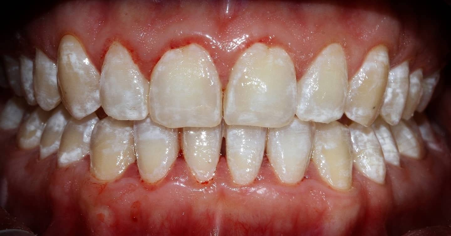 clinica-dental-cuauhtli-before