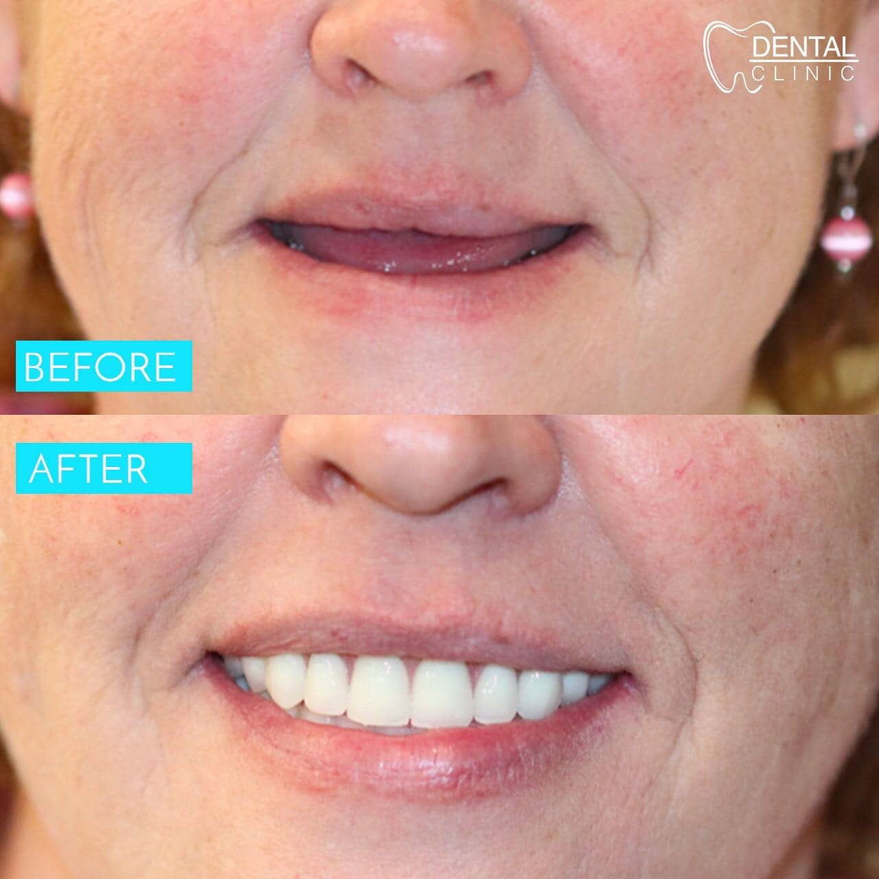 dental-clinic-before-after-1