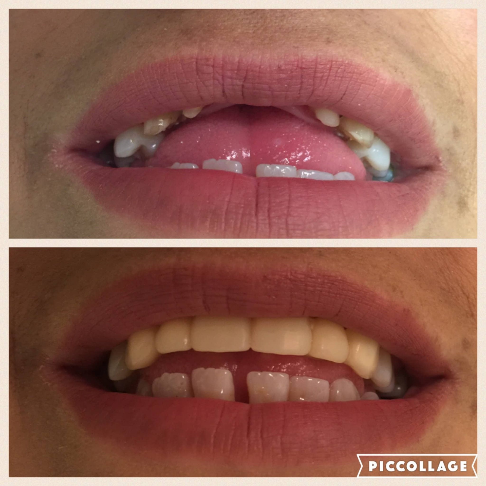 Laredo Smile Center Dental Mexico