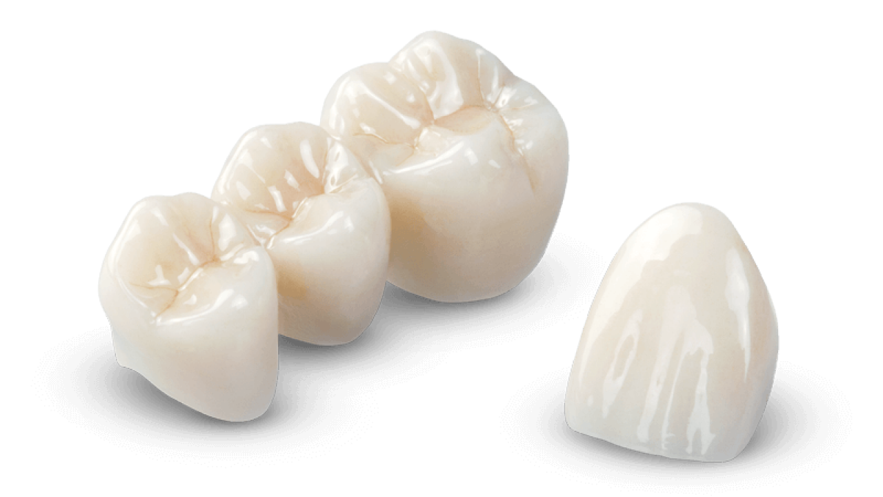 3 Unit Bridge Dental Bridge Medicare Dental Clinic